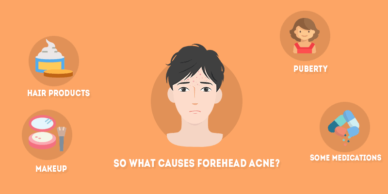 What Causes Forehead Acne