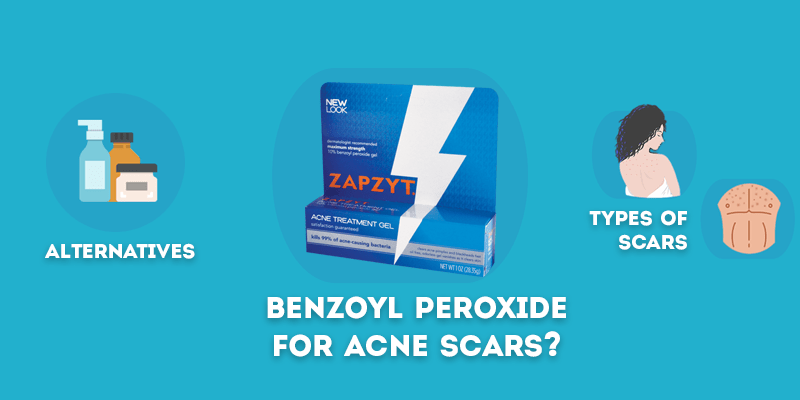 benzoyl peroxide for acne scars