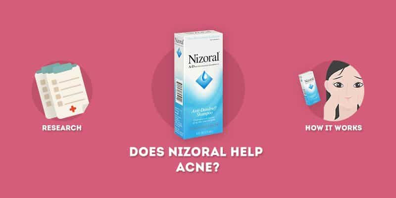 can you use nizoral for acne