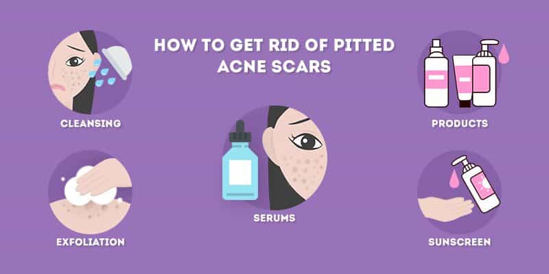 how to get rid of pitted acne scars at home