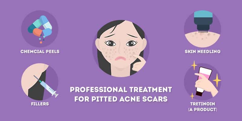 professional treatments for severe pitted acne scars