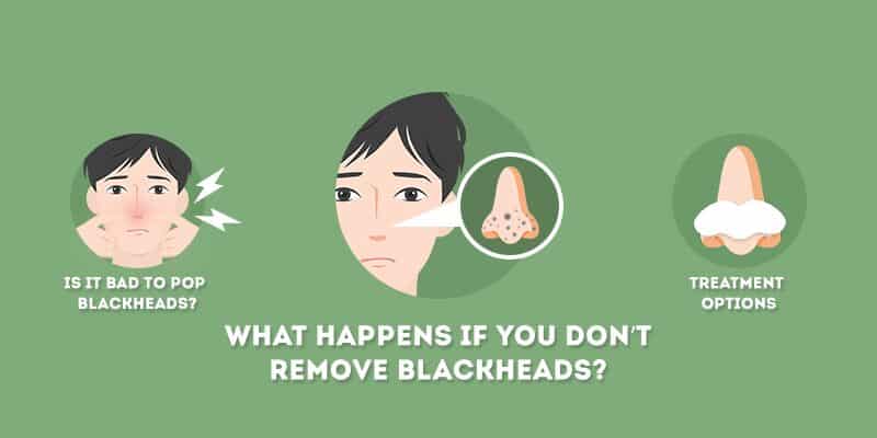 what happens if you dont remove blackheads