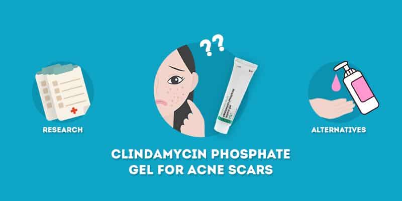clindamycin phosphate gel for acne scars