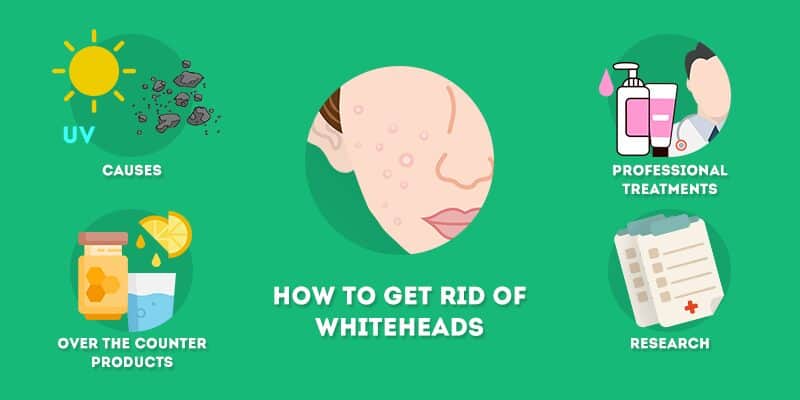how to get rid of whiteheads