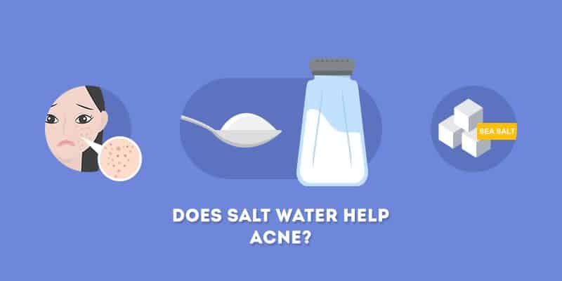 Does Salt Water Help Acne