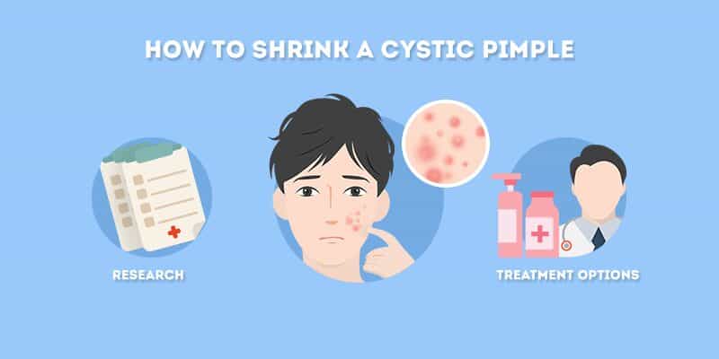 How to Shrink a Cystic Pimple