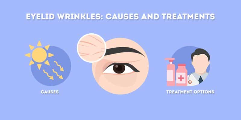 Eyelid Wrinkles: Causes and Treatments