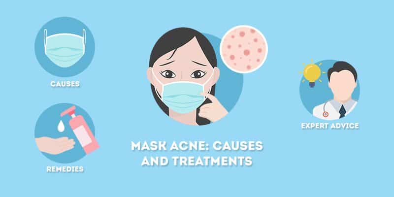 Mask Acne - Causes and Treatment Options for Mask Acne